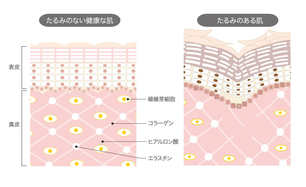 年代別のお肌の悩み 50代 60代の方 メディアージュクリニック大阪梅田院 美容皮膚科 エイジマネージメント