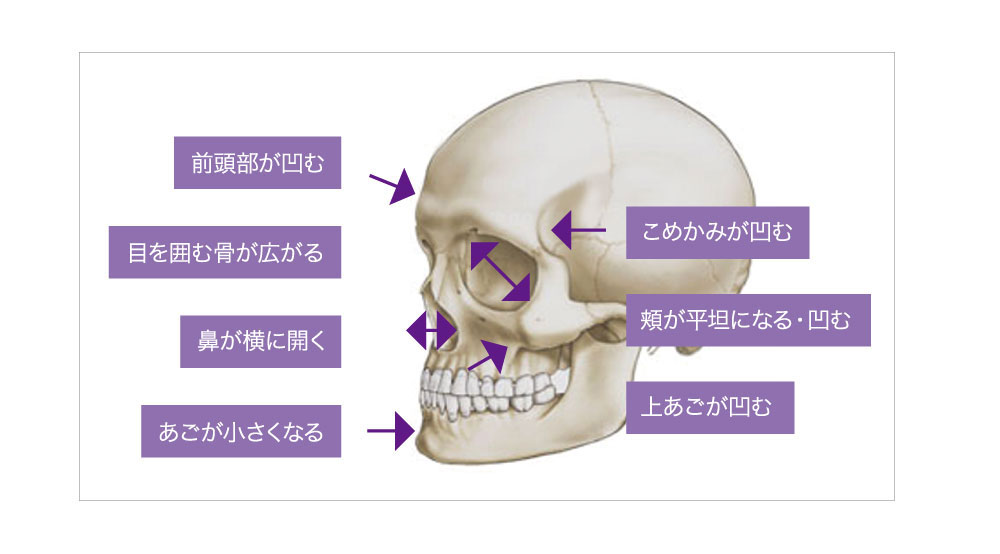 年代別のお肌の悩み 50代 60代の方 メディアージュクリニック大阪梅田院 美容皮膚科 エイジマネージメント